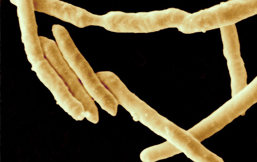 Иерсиниоз. Большая российская энциклопедия