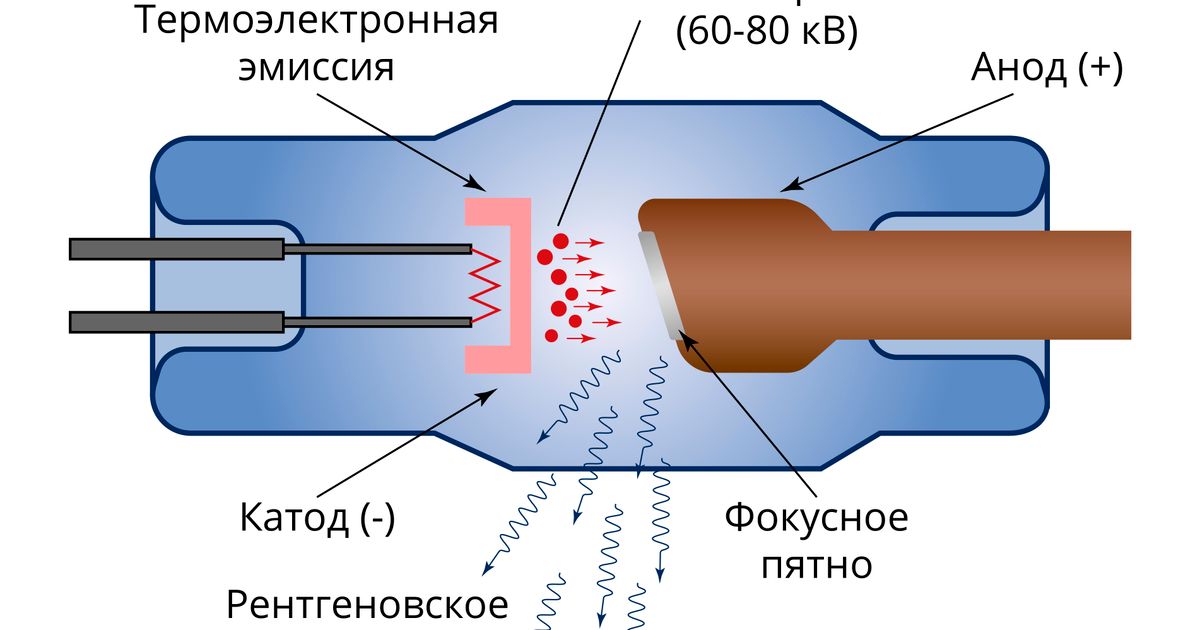 Рентгеновская трубка фото