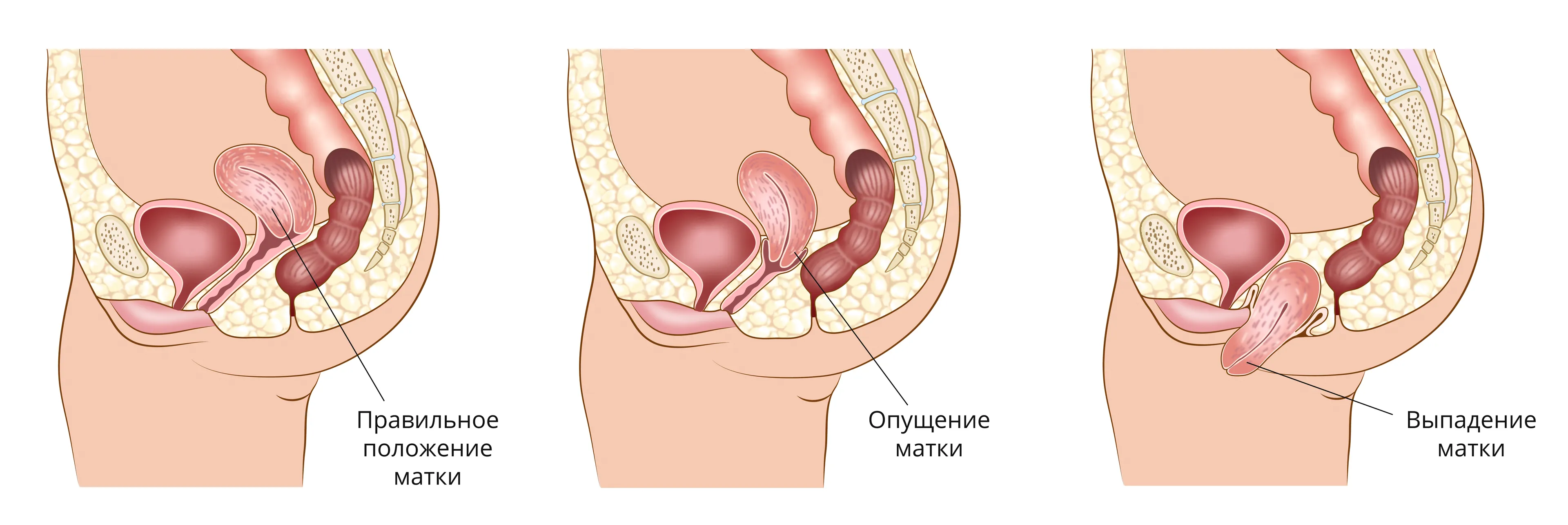 оргазм и гипертонус матки при беременности фото 16