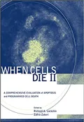 When cells die II: a com­pre­hen­sive evalua­tion of apop­to­sis and pro­grammed cell death