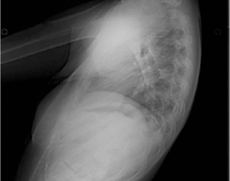 Лордоз. Большая российская энциклопедия