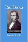 Paul Broca