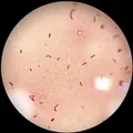 Микроскопия окрашенной по Граму кишечной палочки (Escherichia coli)