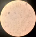 Перевиваемая монослойная клеточная линия эпителия молочной железы человека HBL 100 при подсчёте в камере Горяева в поле зрения светового микроскопа