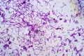 Бактерии актиномицеты (Actinomyces) под микроскопом