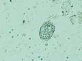 Ооцисты Toxoplasma Gondii под микроскопом