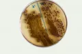 Бактерии сальмонелл (salmonella)