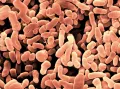 Электронная микрофотография бактерий вида Propionibacterium acnes