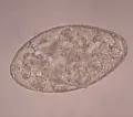 Яйцо Paramphistomum cervi – трематодного типа с крышечкой