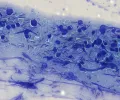 Сибиреязвенная палочка (Bacillus anthracis) в мазке крови