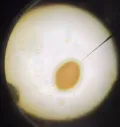 Яйцо Macracanthorhinchus hirudinaceus, увеличение х400