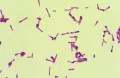 Анаэробная грамположительная бактерия Clostridium botulinum
