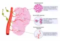 Схематическое изображение лекарственных методов лечения метастатического рака прямой кишки