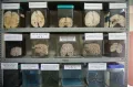 Образцы человеческого мозга с различными энцефалическими нарушениями