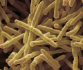 Карбоксидобактерии. Электронная микрофотография Mycobacterium smegmatis
