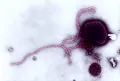 Вирус парагриппа