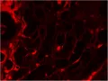 Краситель конго красный, исследованный с помощью флуоресцентного микроскопа с использованием техасского красного фильтра