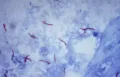 Микрофотография палочки Коха (Mycobacterium tuberculosis), вызывающей туберкулёз у человека и некоторых животных