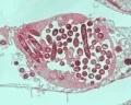 Бактерия легионеллы (Legionella pneumophila)