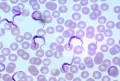 Trypanosoma equiperdum в крови капилляров половых органов