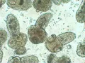 Микрофотография личинки паразита вида Echinococcus multilocularis