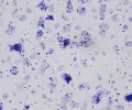 Столбнячная палочка (Clostridium tetani)