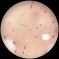 Микроскопия окрашенной по Граму кишечной палочки (Escherichia coli)