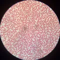 Микрофотография мазка крови человека