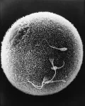 Оплодотворение яйцеклетки. Фото из сканирующего электронного микроскопа