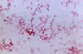 Микрофотография чумной палочки (Yersinia pestis), увеличение х1125
