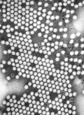 Микрофотография вируса полиомиелита, полученная с помощью просвечивающего электронного микроскопа