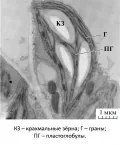 Пластоглобулы на срезах зрелых хлоропластов мезофилла листа резуховидки Таля