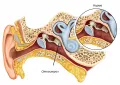 Схематическое изображение отосклероза