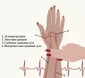 Определение пульса лучевой артерии в дистальном отделе предплечья