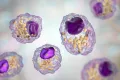Схематическое изображение макрофаговых пенистых клеток