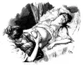 Иллюстрация метода ручного выжимания плаценты при её задержке после родов