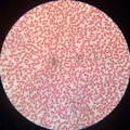 Микрофотография мазка крови человека